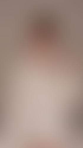 Geblurrte Content-Vorschau