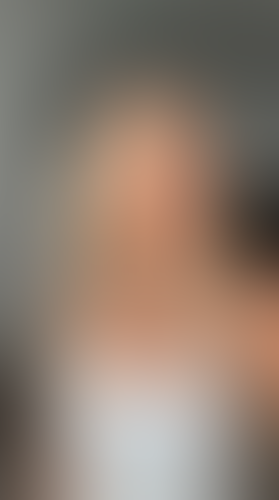 Geblurrte Content-Vorschau