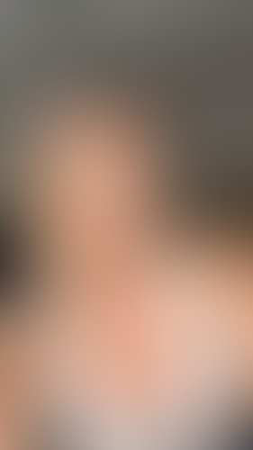 Geblurrte Content-Vorschau