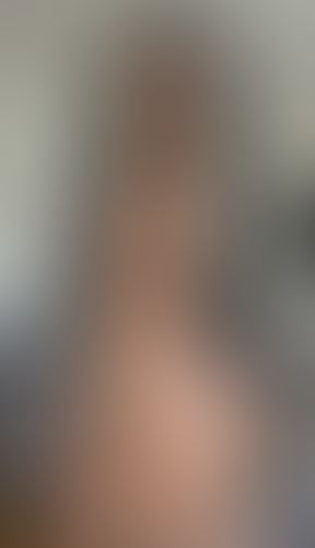 Geblurrte Content-Vorschau
