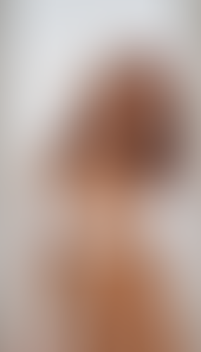 Geblurrte Content-Vorschau
