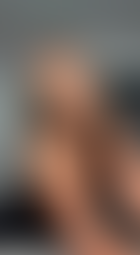 Geblurrte Content-Vorschau