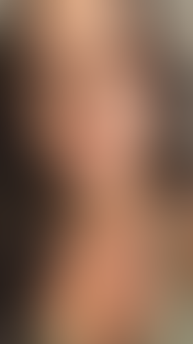 Geblurrte Content-Vorschau