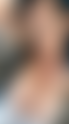 Geblurrte Content-Vorschau