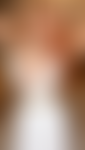 Geblurrte Content-Vorschau