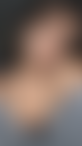Geblurrte Content-Vorschau