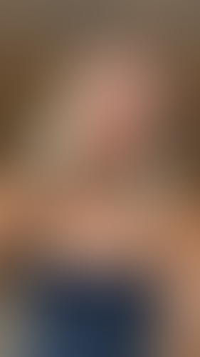 Geblurrte Content-Vorschau