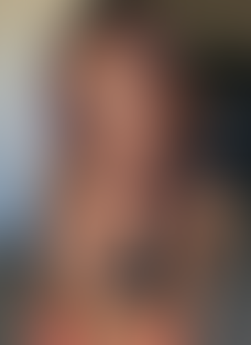 Geblurrte Content-Vorschau