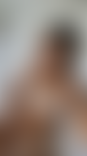 Geblurrte Content-Vorschau