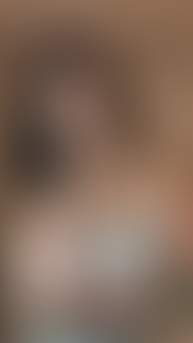 Geblurrte Content-Vorschau
