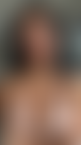 Geblurrte Content-Vorschau