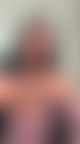 Geblurrte Content-Vorschau