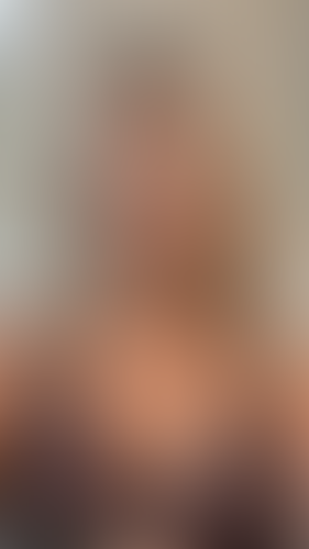 Geblurrte Content-Vorschau