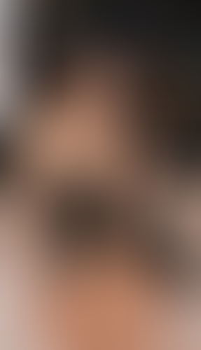 Geblurrte Content-Vorschau