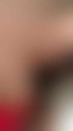 Geblurrte Content-Vorschau