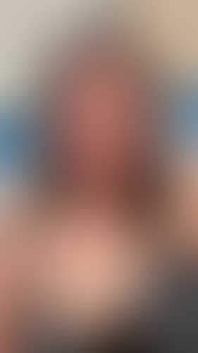 Geblurrte Content-Vorschau