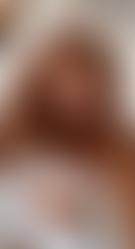 Geblurrte Content-Vorschau
