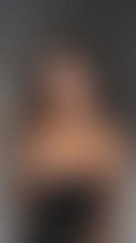 Geblurrte Content-Vorschau