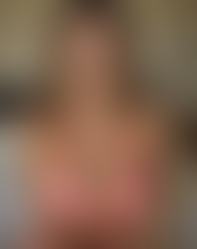 Geblurrte Content-Vorschau