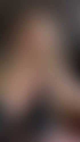 Geblurrte Content-Vorschau