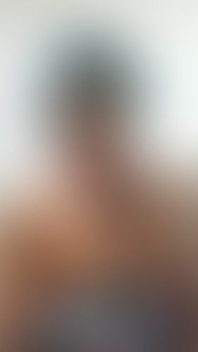 Geblurrte Content-Vorschau