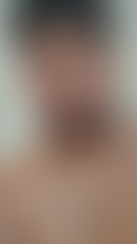 Geblurrte Content-Vorschau
