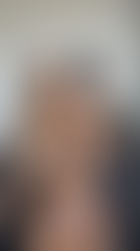 Geblurrte Content-Vorschau