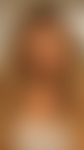 Geblurrte Content-Vorschau