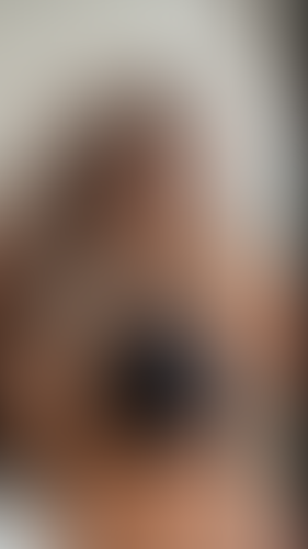 Geblurrte Content-Vorschau