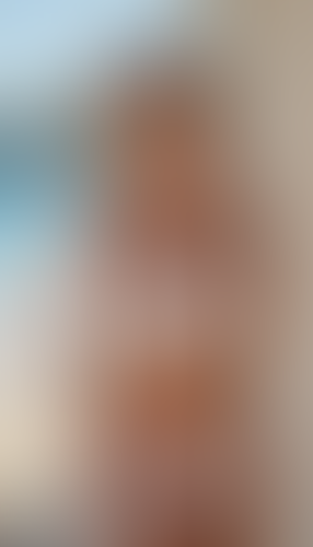 Geblurrte Content-Vorschau