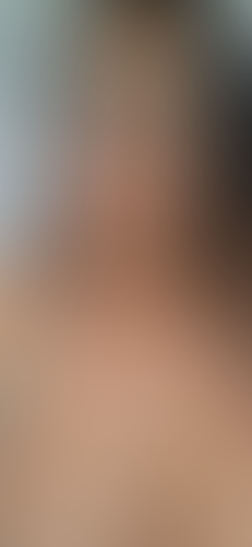 Geblurrte Content-Vorschau