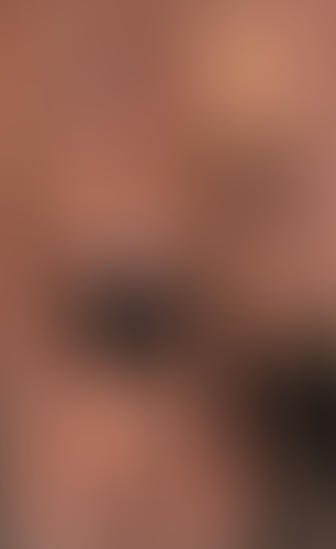 Geblurrte Content-Vorschau
