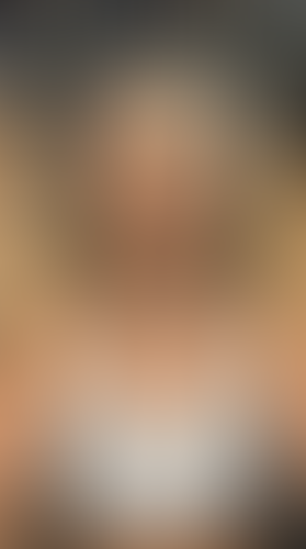 Geblurrte Content-Vorschau