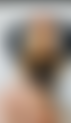 Geblurrte Content-Vorschau