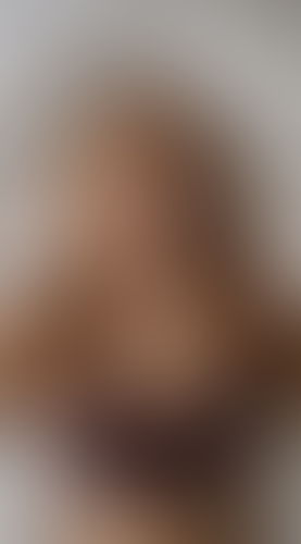 Geblurrte Content-Vorschau