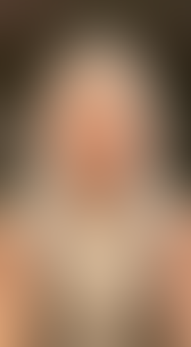 Geblurrte Content-Vorschau