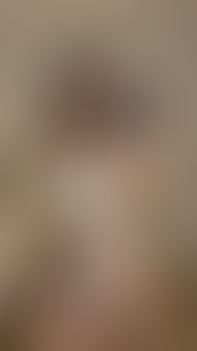 Geblurrte Content-Vorschau