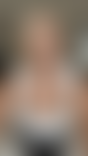 Geblurrte Content-Vorschau