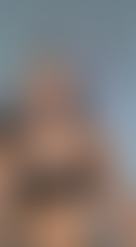 Geblurrte Content-Vorschau
