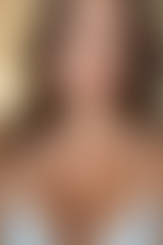 Geblurrte Content-Vorschau
