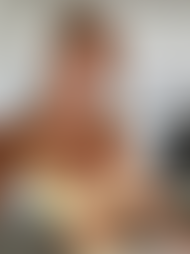 Geblurrte Content-Vorschau