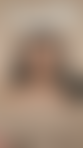 Geblurrte Content-Vorschau