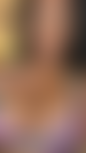 Geblurrte Content-Vorschau