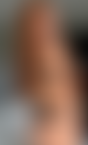 Geblurrte Content-Vorschau