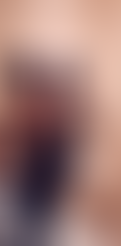 Geblurrte Content-Vorschau