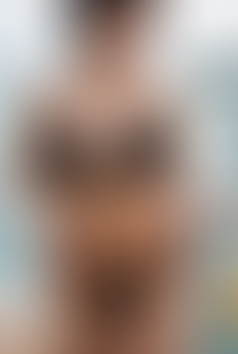 Geblurrte Content-Vorschau