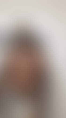 Geblurrte Content-Vorschau