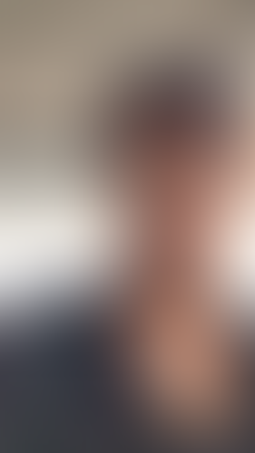 Geblurrte Content-Vorschau
