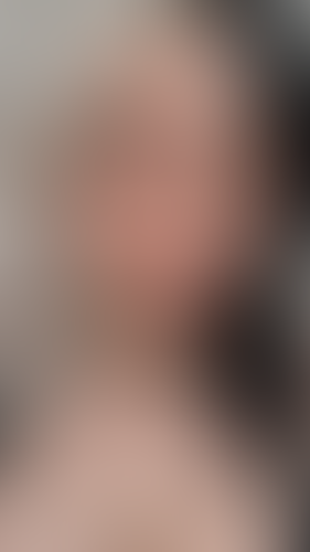 Geblurrte Content-Vorschau