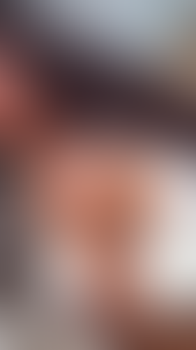 Geblurrte Content-Vorschau